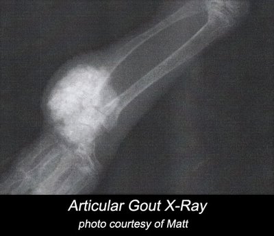 X-ray of a chameleon with gout.